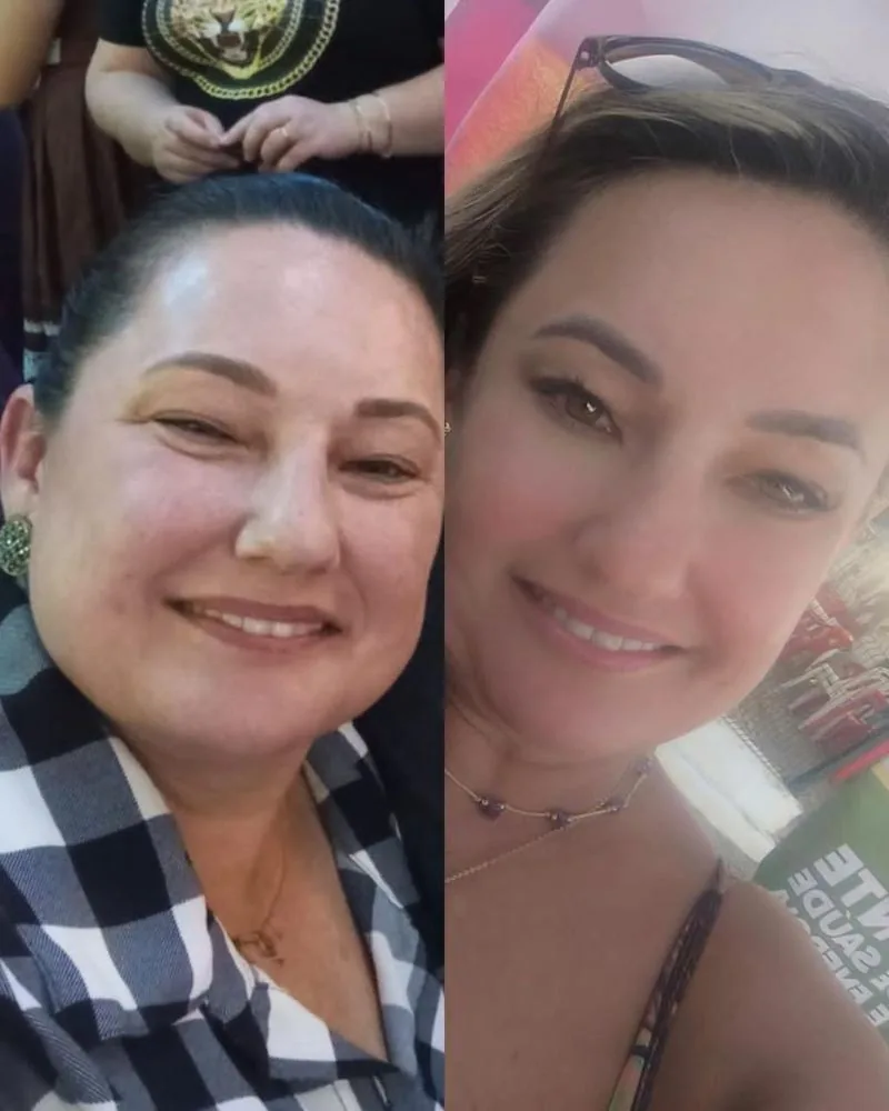 Resultado antes e depois